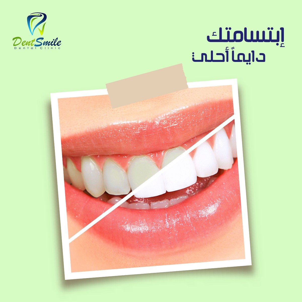 dent smile - Event Image 12