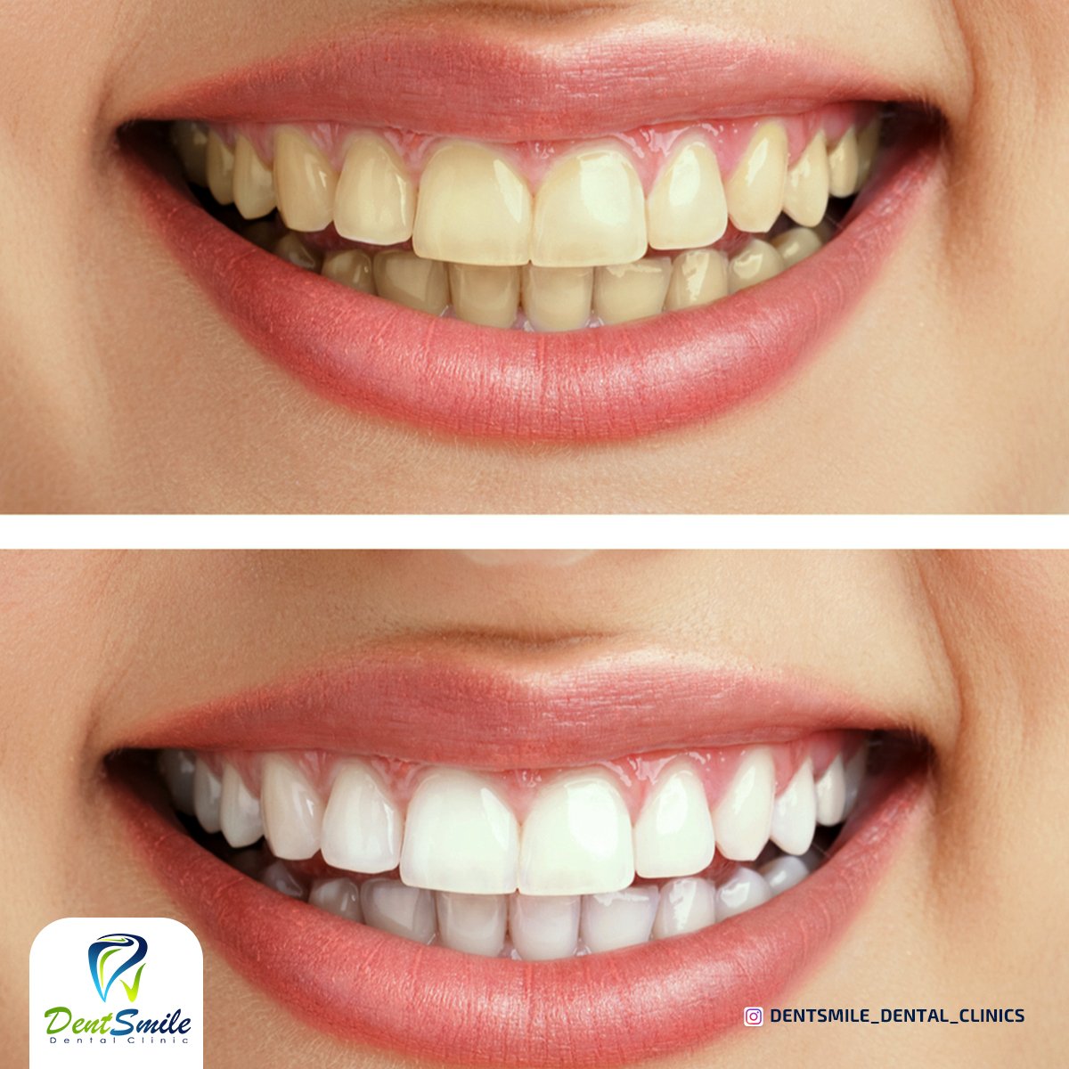 dent smile - Event Image 14