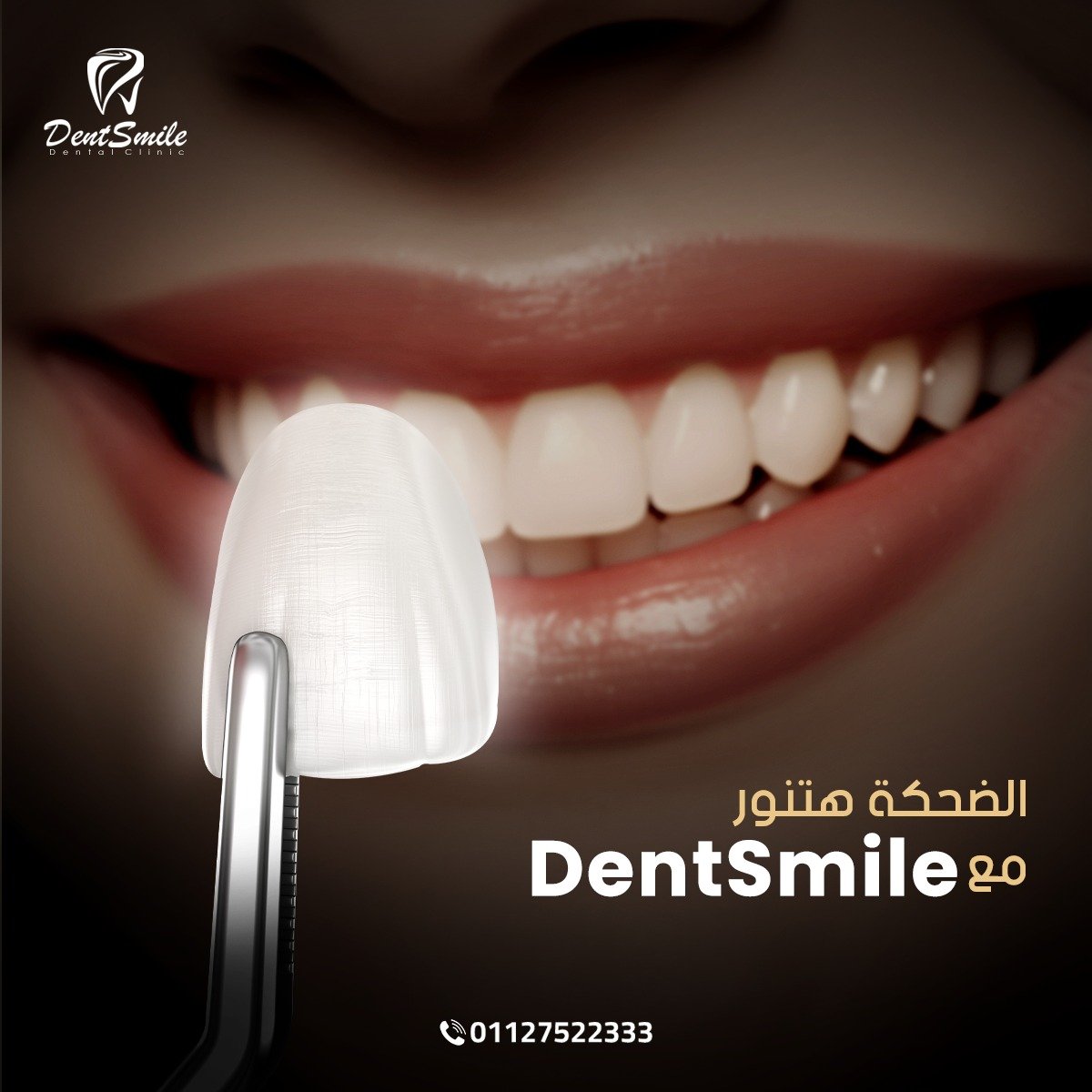 dent smile - Event Image 30